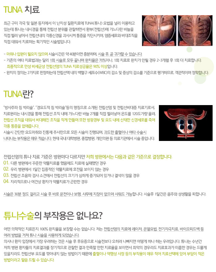 전립선 튜나수술 이미지