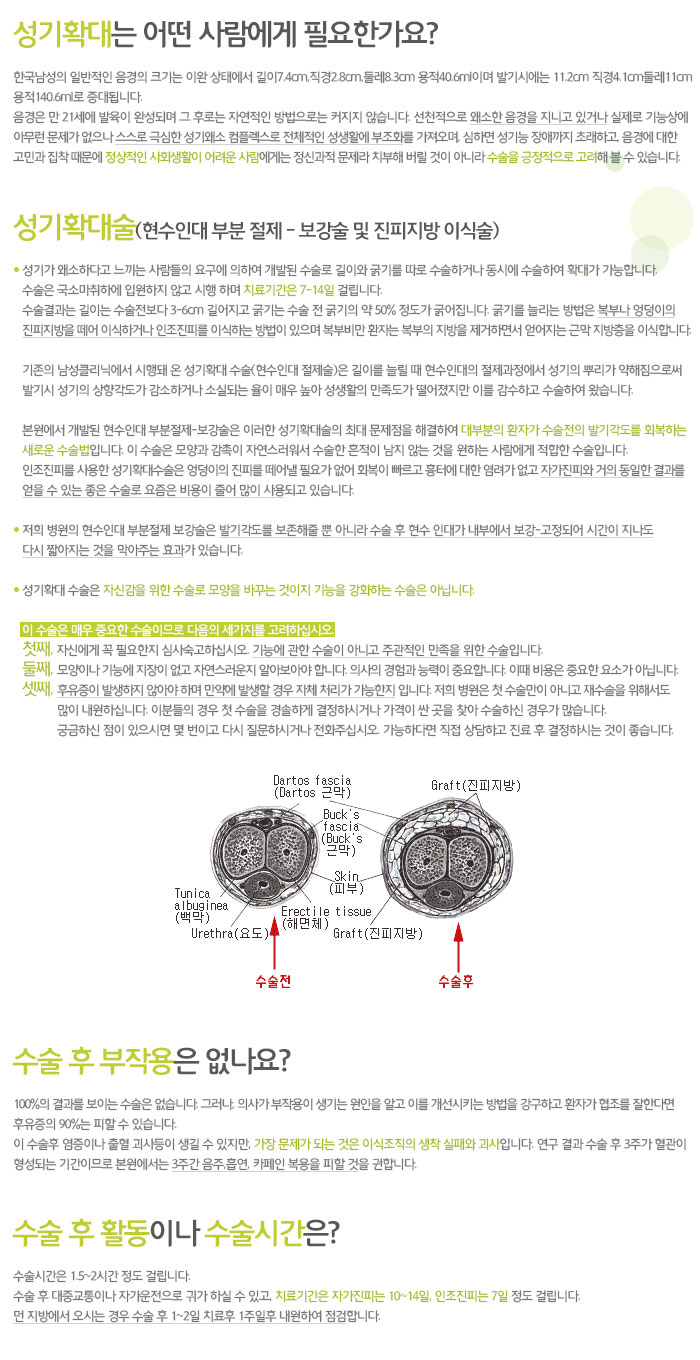 성기확대 이미지